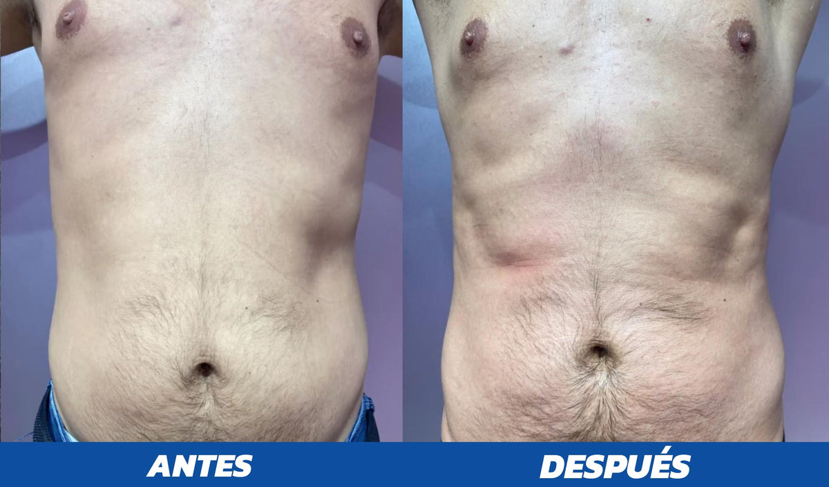 antes-despues1