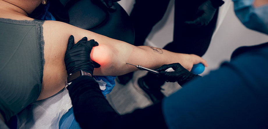 endolaser-tratamiento-en-brazo