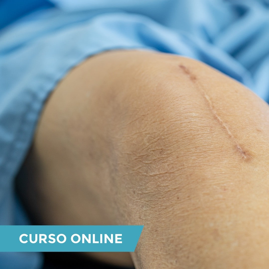 Curso Internacional en Manejo de Cicatrices