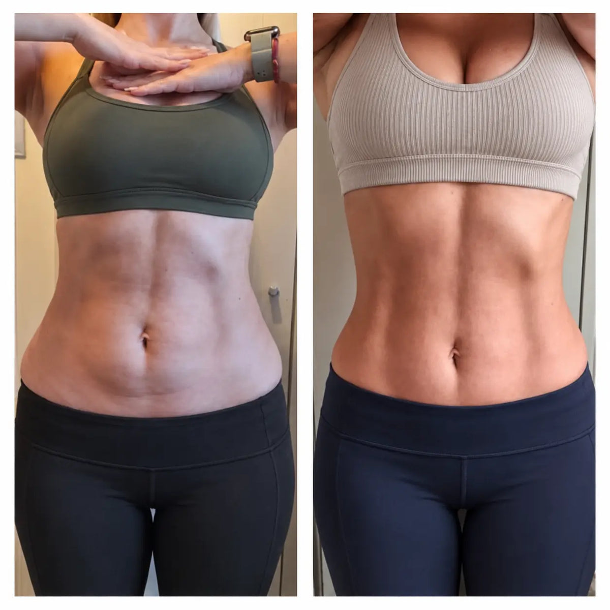 Antes y después de abdomen, vista frontal